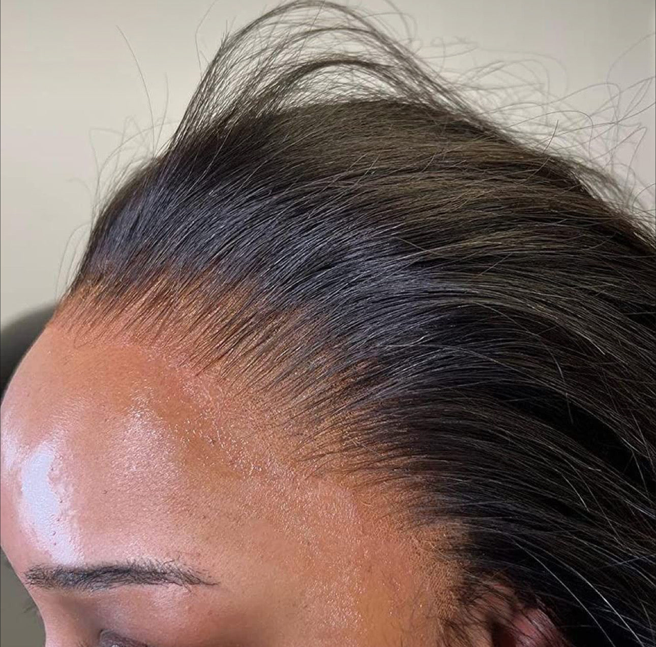 1B Virgin Hair HD Closures & Frontals